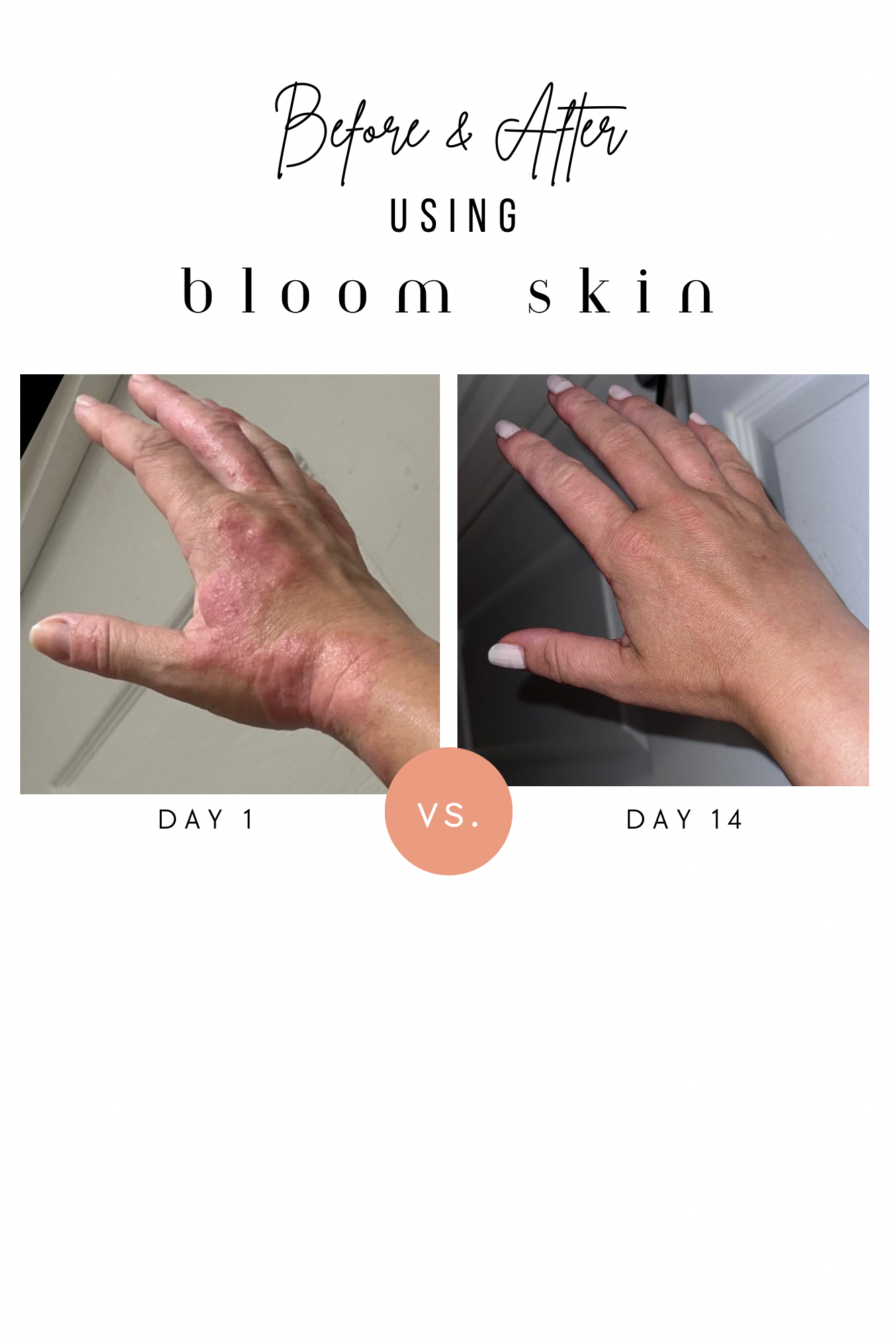 Multipurpose Balm