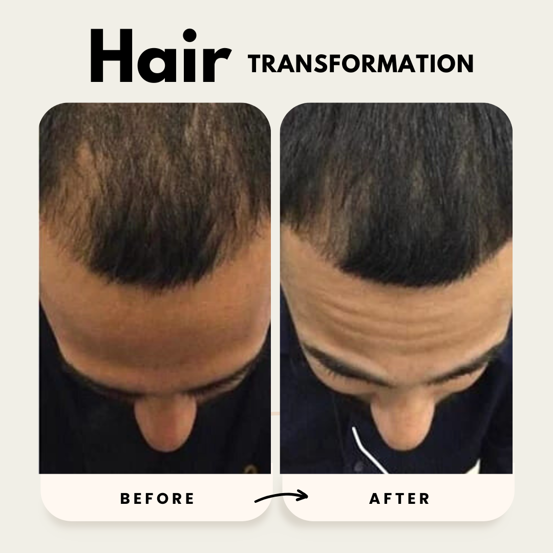 Hair Growth Trio Shampoo Conditioner Oil Set
