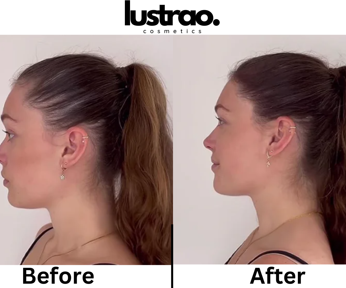 Hair Regrowth Oil for Thinning and Loss