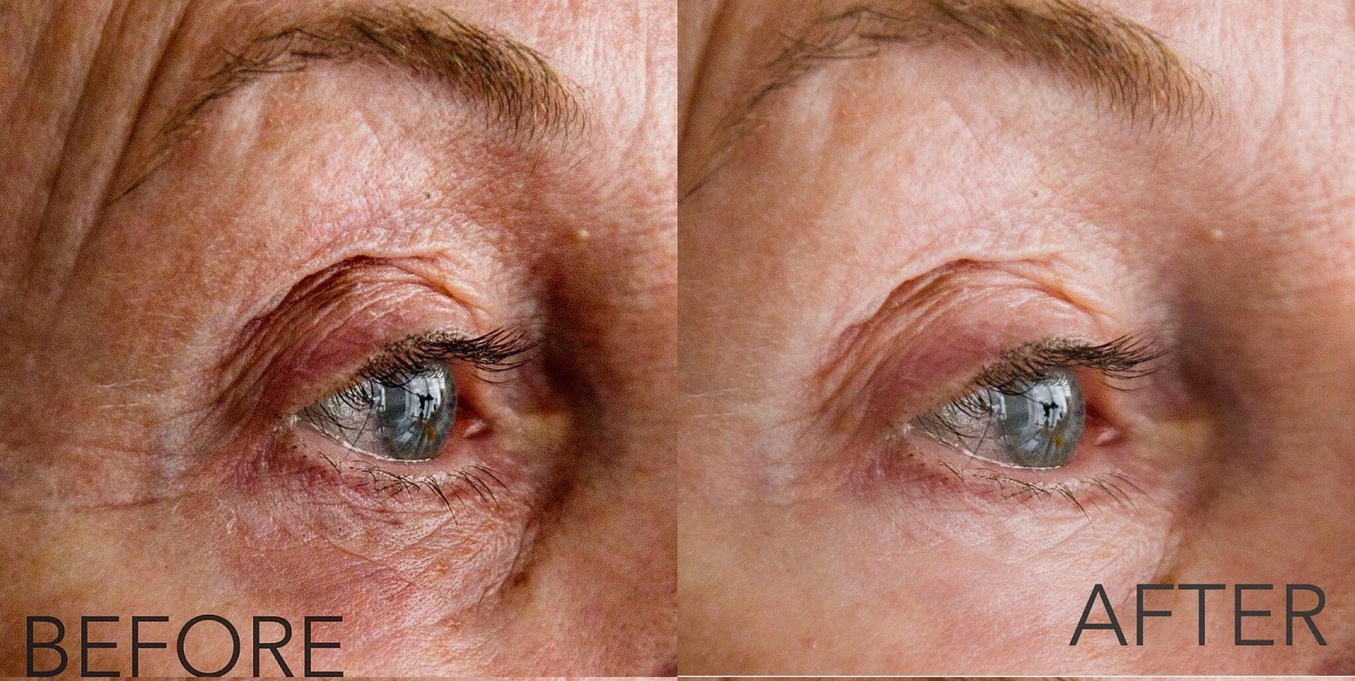 Active Protection Eye Serum 15ml