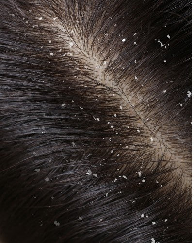 a soft-lit gift set for sensitive scalps with peat shampoo and conditioner, tied with a ribbon